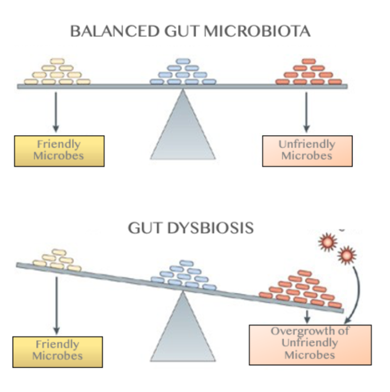 How Your Gut Microbiome Can Affect Your Health - HER'OLOGY