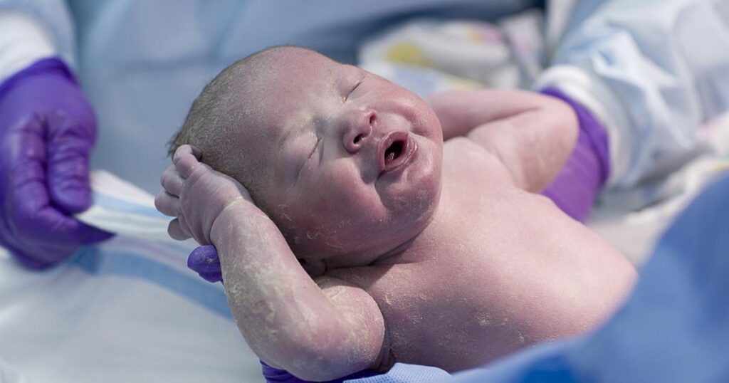 Newborn baby coated with healthy bacteria and vernix.