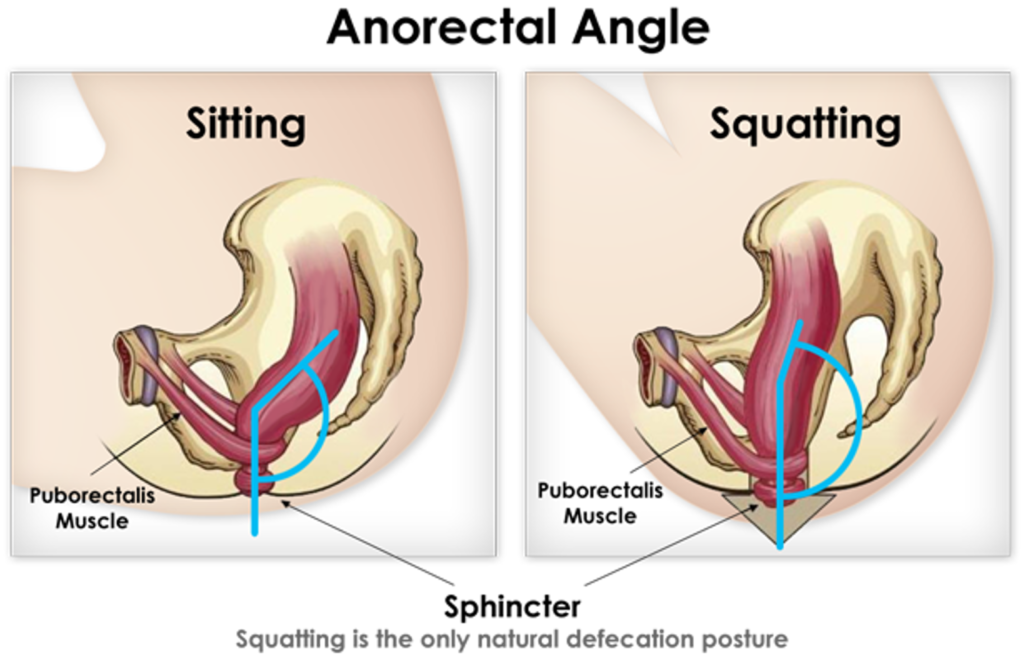 Anorectal angle is the poop position that makes it difficult for things to flow naturally. 